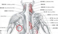 鶴ヶ島市 男性会社員 背中の痛み 左の背中が痛いんです 広背筋損傷 ふじみ接骨院