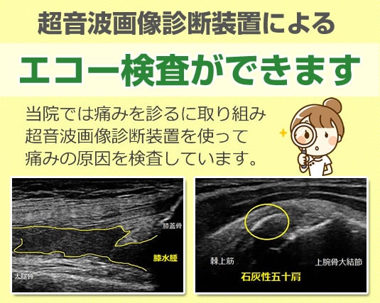 エコー検査ができます